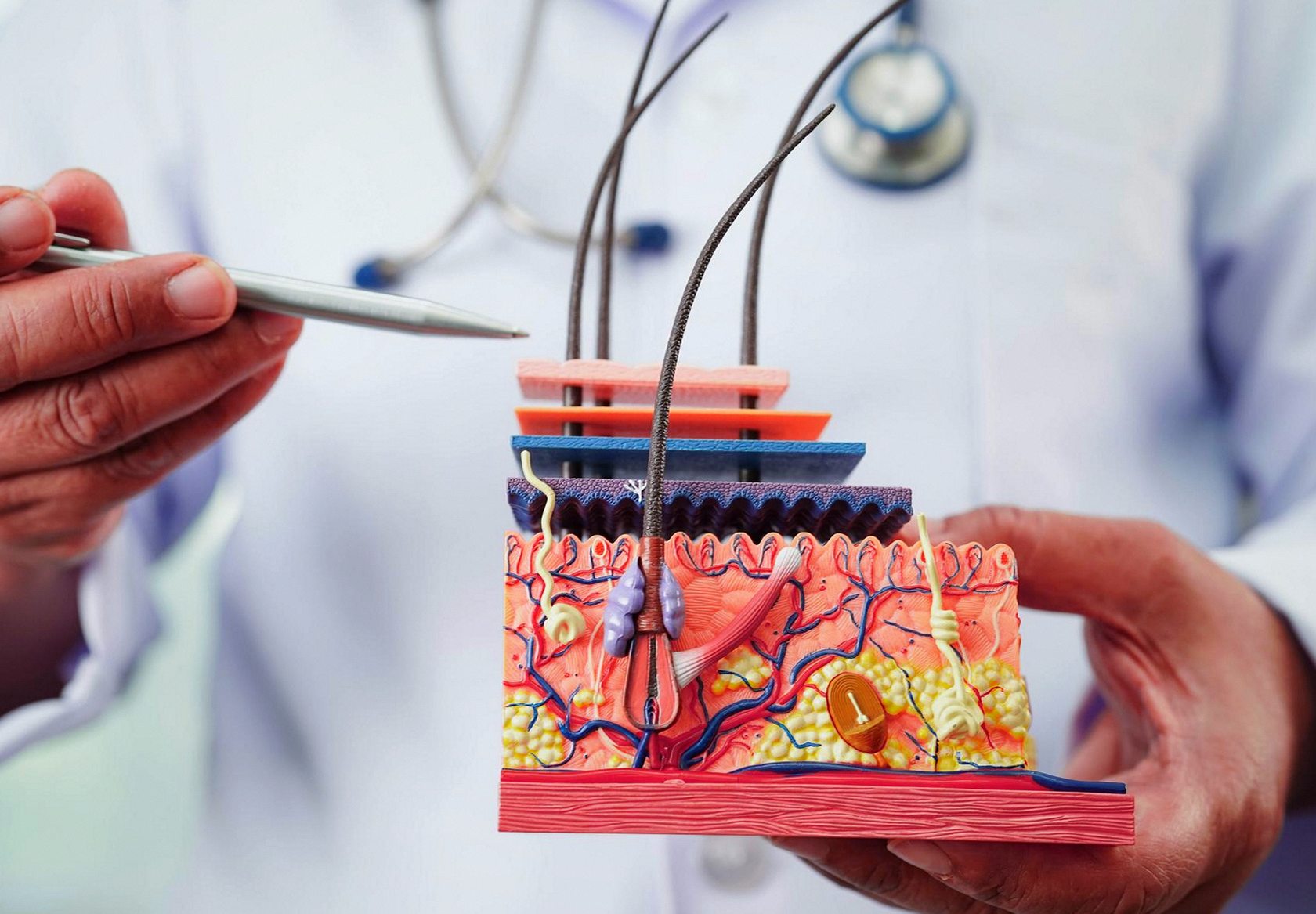 Anatomický řez vlasem a pokožkou hlavy — vlasový folikul a kořínek